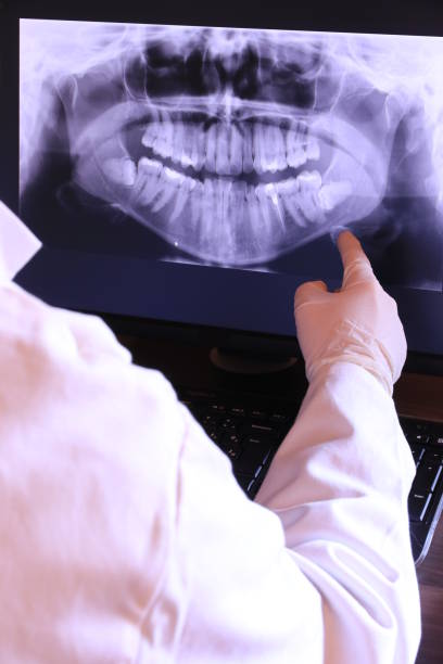 Best Emergency Wisdom Teeth Removal in Old Forge, PA