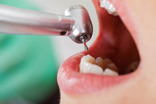 Best Emergency Gum Treatment in Old Forge, PA